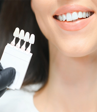 esnek-gülüş-tasarımı