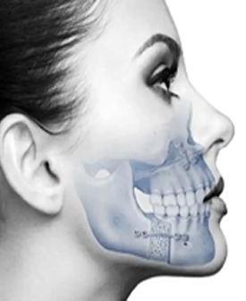 Çene (Ortognatik) Cerrahisi